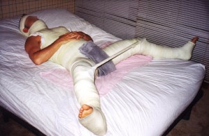 doente-acidente-domestico