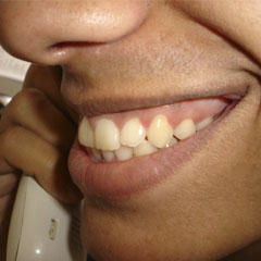 Sorrir