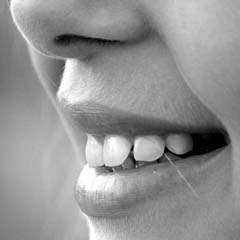 Dentes